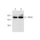 Dieser polyklonale Antikörper wird nicht mehr hergestellt. Wir empfehlen Ihnen unseren <a href="tresk-antibody-e-2">TRESK (E-2)</a> monoklonalen Antikörper (Beispielsdaten werden angezeigt). western blotting image from recommended TRESK (E-2) monoclonal antibody replacement. Image 323810