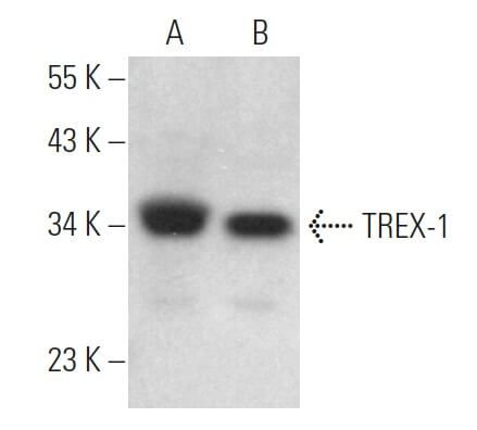 TREX-1抗体(E-6) | SCBT - Santa Cruz Biotechnology