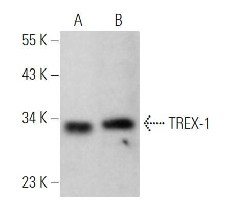 TREX-1 Antibody (E-6) | SCBT - Santa Cruz Biotechnology TREX-1 Antibody (E-6) | SCBT - Santa Cruz Biotechnology