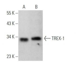 TREX-1 Antibody (E-6) - Western Blotting - Image 371960