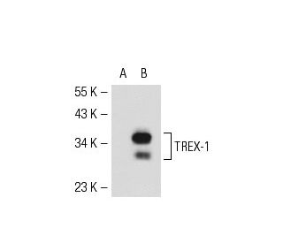 TREX-1 Antibody (C-11) - Western Blotting - Image 54126 