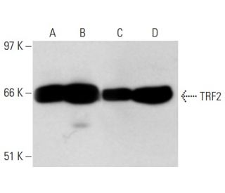 TRF2 Antibody (4A794) - Western Blotting - Image 17753 