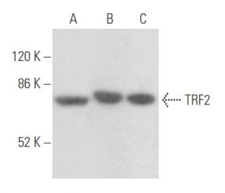 TRF2 Antibody (9F10) - Western Blotting - Image 355444 