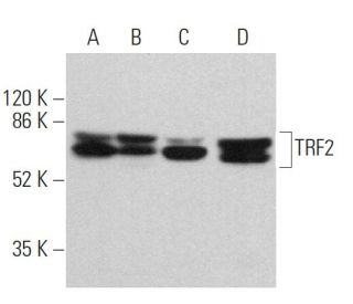 TRF2 Antibody (B-5) - Western Blotting - Image 359727 