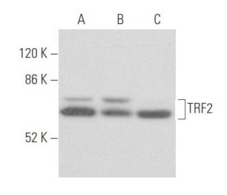 western blotting image from recommended TRF2 (B-5) monoclonal antibody replacement. Image 355445