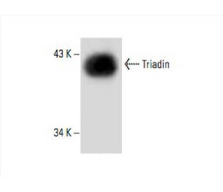 Triadin Antibody (IIG12) - Western Blotting - Image 394095SAM Transcription Activation: SAM system utilizing dCas9-VP64, MS2-P65-HSF1, and sgRNA for precise gene transcription activation.