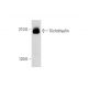 Trichohyalin Antibody (E-11) - Western Blotting - Image 323813 