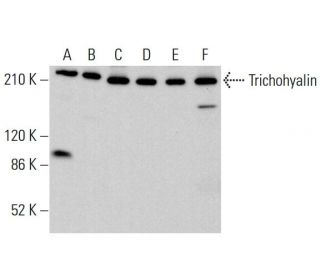 Trichohyalin Antibody (F-2) - Western Blotting - Image 382204 