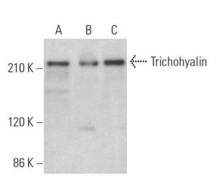 Trichohyalin Antibody (E-11) - Western Blotting - Image 359188 