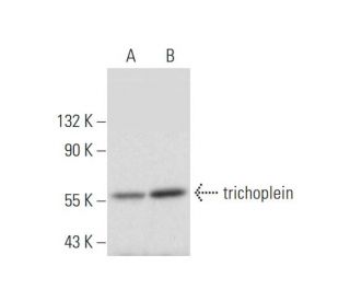 trichoplein Antibody (G-2) - Western Blotting - Image 333731 
