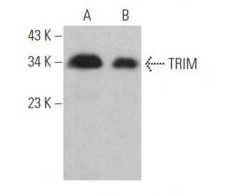 TRIM Antibody (D-2) - Western Blotting - Image 367211 