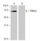 TRIM32 Antibody (8H8) - Western Blotting - Image 65081