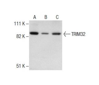 TRIM32 Antibody (8H8) - Western Blotting - Image 287530 