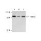 TRIM32 Antibody (8H8) - Western Blotting - Image 287530 