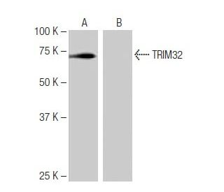TRIM32 Antibody (8H8) - Western Blotting - Image 65081