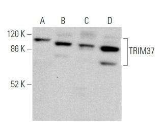 TRIM37 Antibody (B-11) | SCBT - Santa Cruz Biotechnology