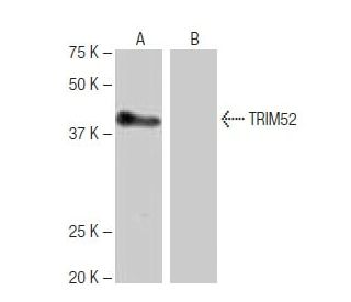 TRIM52 Antibody (3-YD23) - Western Blotting - Image 65082