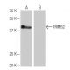 TRIM52 Antibody (3-YD23) - Western Blotting - Image 65082