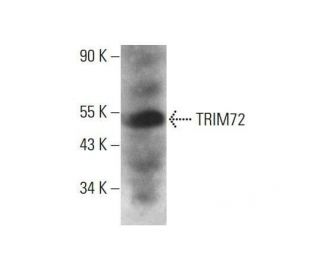 TRIM72 Antibody (A-10) - Western Blotting - Image 351837 