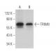 TRIM8 Antibody (B-3) - Western Blotting - Image 366001