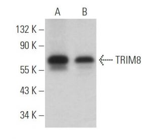 TRIM8 Antibody (B-3) - Western Blotting - Image 366001The Double Nickase Plasmid features a U6 promoter for sgRNA expression, a 20 nt targeting sequence, and a gRNA scaffold to guide Cas9n. It includes a CBh promoter for Cas9n (D10A) and puromycin resistance, GFP for transfection verification, and nuclear localization signals (NLS). The 2A peptide allows co-expression of Cas9n and Puro from a single promoter, enabling precise genome editing with reduced off-target effects. 