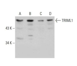 TRIML1 Antibody (S-42) - Western Blotting - Image 385123 