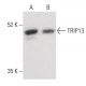 TRIP13 Antibody (A-7) - Western Blotting - Image 400403