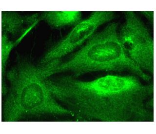 TrkB Antibody (F-1) - Immunofluorescence - Image 284678 