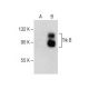 TrkB Antibody (F-1) - Western Blotting - Image 282555 