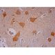 immunohistochemistry image from recommended TrkB (F-1) monoclonal antibody replacement. Image 293512