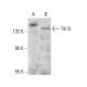 TrkB Antibody (H--8) - Western Blotting - Image 378987