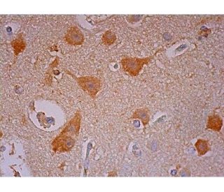 immunohistochemistry image from recommended TrkB (F-1) monoclonal antibody replacement. Image 293512