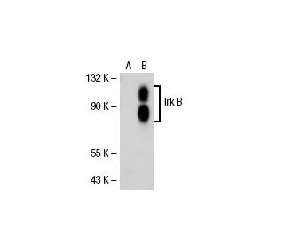 Trk B (L30-1): sc-80400. Western blot analysis of Trk B... 