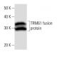 TRM61 Antibody (C145I165) - Western Blotting - Image 16823