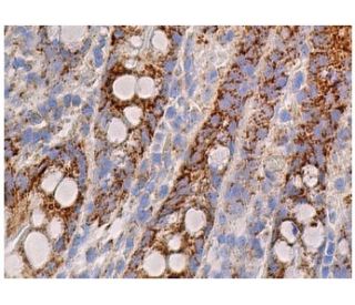 TRMT1 Antibody (G-3) - Immunohistochemistry - Image 160978 