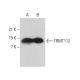 TRMT112 Antibody (F-7) - Western Blotting - Image 376393