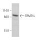 TRMT1L Antibody (H-8) - Western Blotting - Image 364952