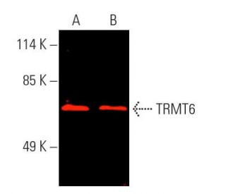 TRMT6 Antibody (F-3) - Western Blotting - Image 389478