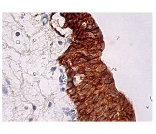 TROP-2 Antibody (F-5) - Immunohistochemistry - Image 157967 