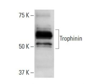 Trophinin Antibody (clone 3-11) - Western Blotting - Image 137493
