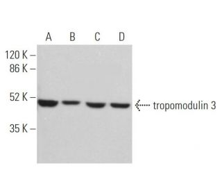 tropomodulin 3 Antibody (E-3) - Western Blotting - Image 371659