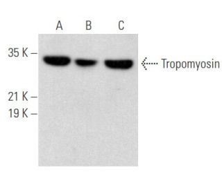 western blotting image from recommended Tropomyosin (F-6) monoclonal antibody replacement. Image 355486