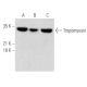 western blotting image from recommended Tropomyosin (F-6) monoclonal antibody replacement. Image 355486