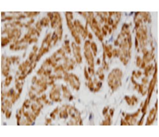 Tropomyosin &beta; Antibody (3C8) - Immunohistochemistry - Image 346126 