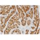 Tropomyosin β Antibody (3C8) - Immunohistochemistry - Image 346126 
