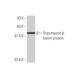 Tropomyosin β Antibody (3C8) - Western Blotting - Image 348867