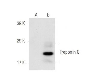 Troponin C slow skeletal/cardiac Antibody (1A2) - Western Blotting - Image 58828