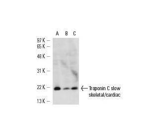 Troponin C slow skeletal/cardiac Antibody (1A2) - Western Blotting - Image 13617 