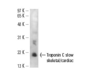 Troponin C slow skeletal/cardiac Antibody (7B9) - Western Blotting - Image 13619 