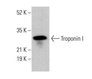 Troponin I Antibody (12) - Western Blotting - Image 376692